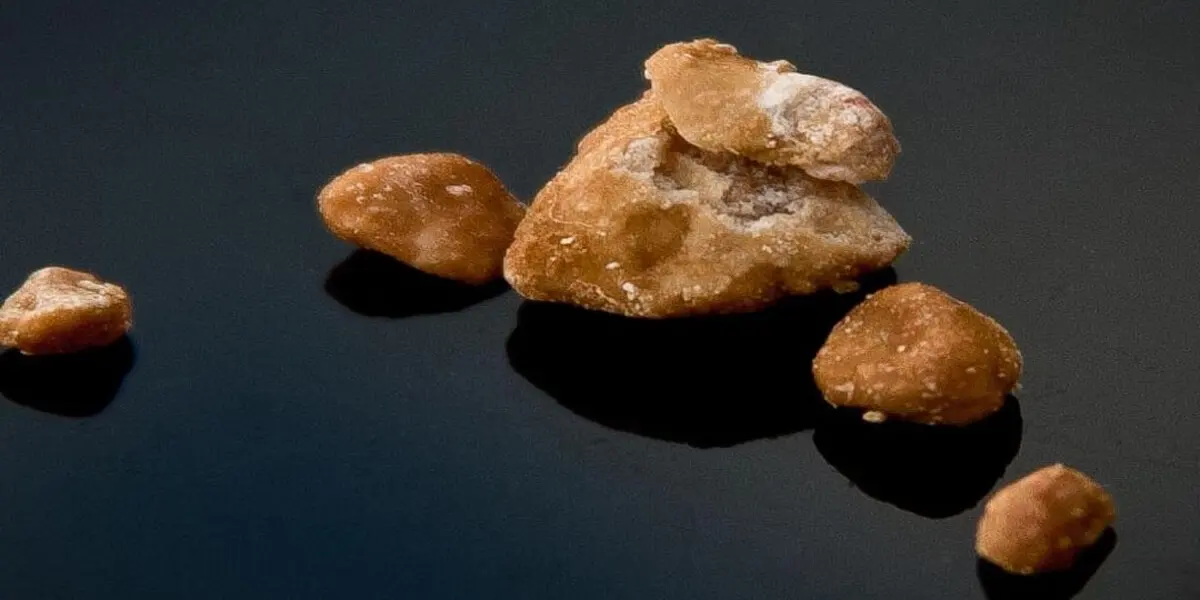 Böbrek ve Üreter Taşı